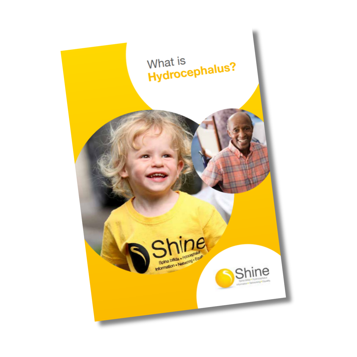 What is Hydrocephalus (print version)